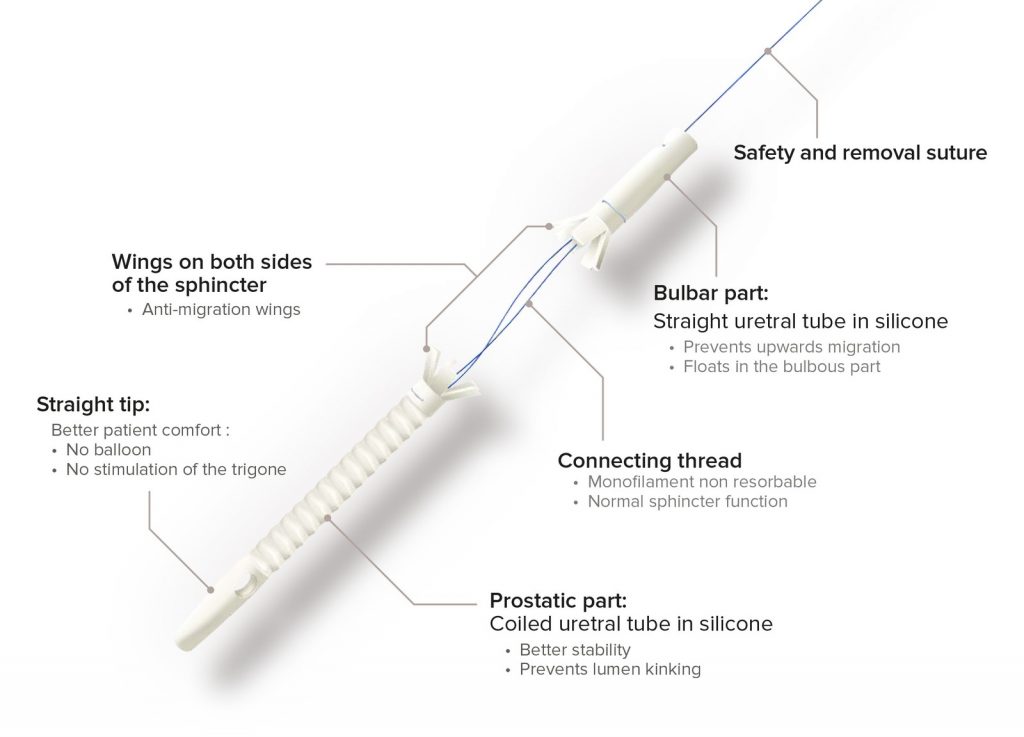 EXIME® Temporary Prostatic Stent Schema Diagram