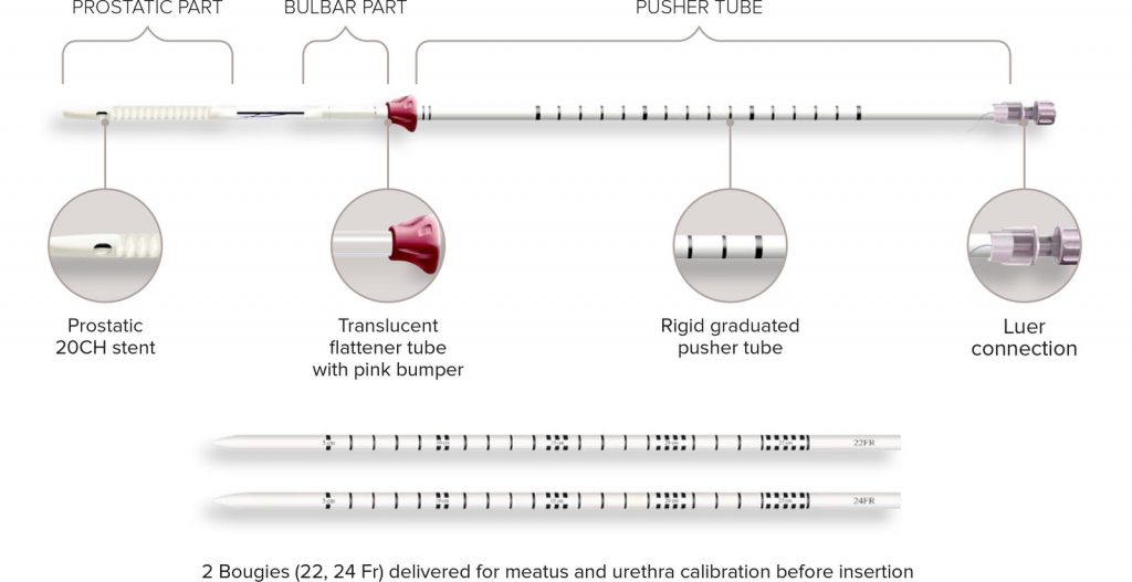 EXIME® Stent Placement Anatomical Schema